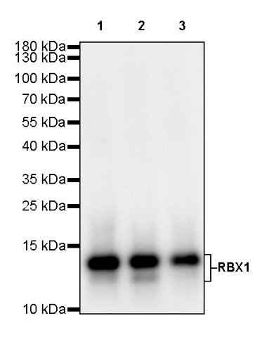 RBX1 Recombinant Rabbit mAb (S-R355)