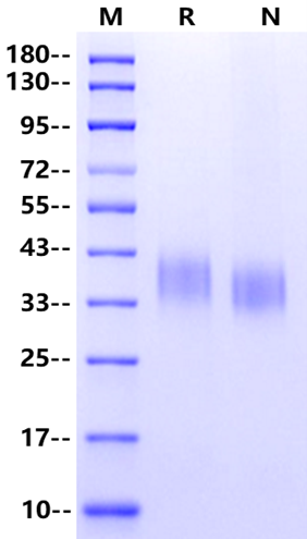 ASGR1 His Tag Protein, Human