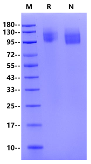 CEACAM-5/CD66e His Tag Protein, Human