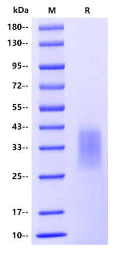 Mouse CCL2/JE/MCP-1 Protein, His tag