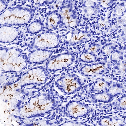 S-RMab® Helicobacter pylori Recombinant Rabbit mAb (SDT-R273)