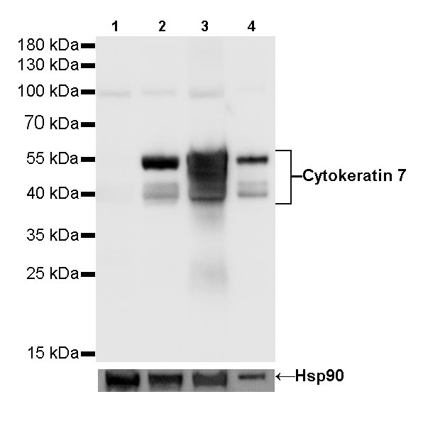 Cytokeratin 7 Recombinant Rabbit mAb (SDT-R028)