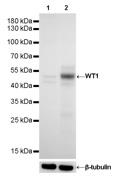 Wilms Tumor Protein (WT1) Recombinant Rabbit mAb (SDT-2864)