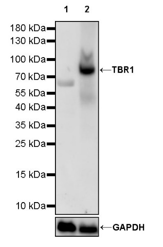 TBR1 Recombinant Rabbit mAb (S-1102-34)