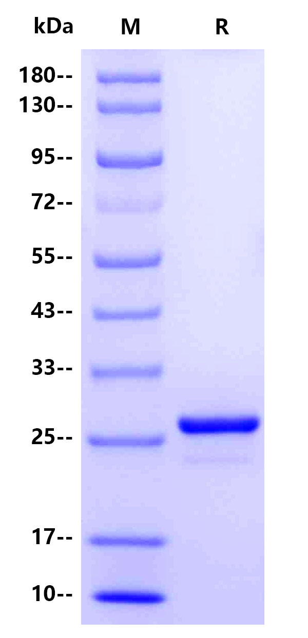 Human Dystrophin, His Tag