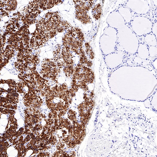 PTH Recombinant Rabbit mAb (S-539-28)