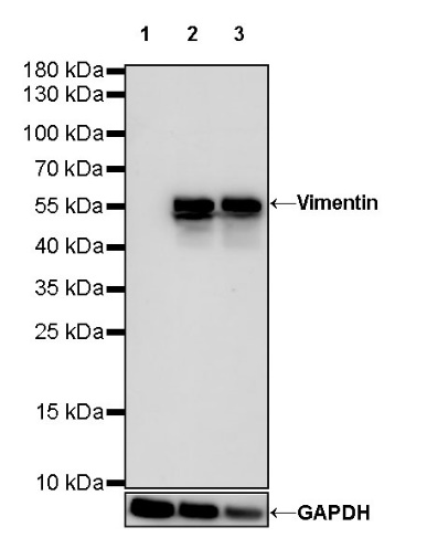 Vimentin Recombinant Rabbit mAb (SDT-029-120)