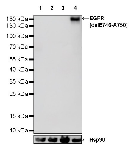 EGFR (delE746-A750) Recombinant Rabbit mAb (S-451-168)
