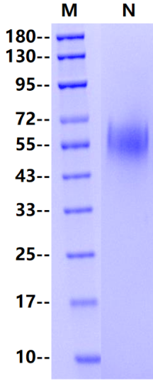 B7-H7/HHLA2 His Tag Protein, Human