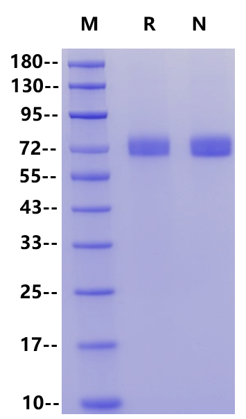 H7N9 HA (Shanghai/2/2013) His Tag Protein, Influenza