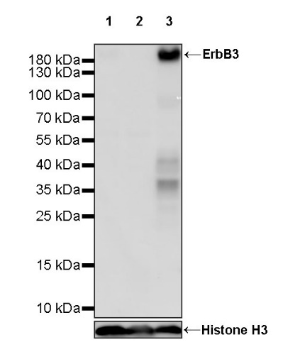ErbB3 Recombinant Rabbit mAb (SDT-991-14)