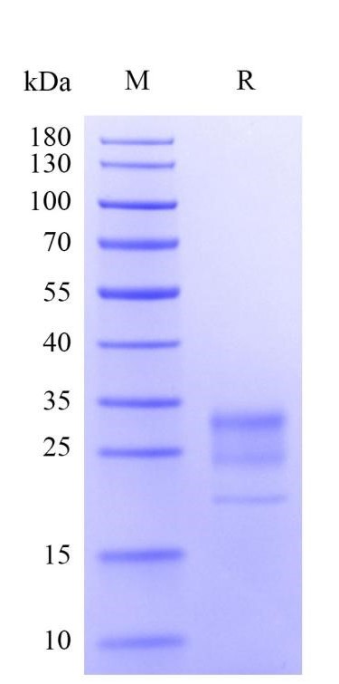 Human IFN-gamma, His Tag