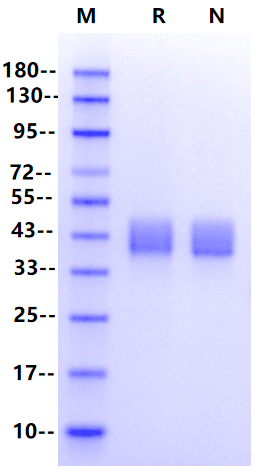 MSLN/Mesothelin (296-580) His Tag Protein, Human