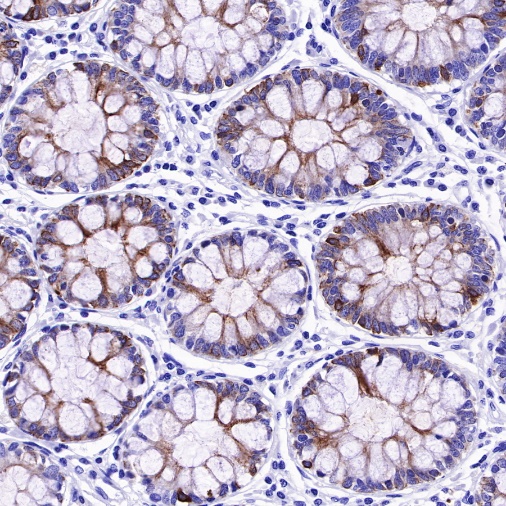 MUC4 Recombinant Rabbit mAb (SDT-R228)