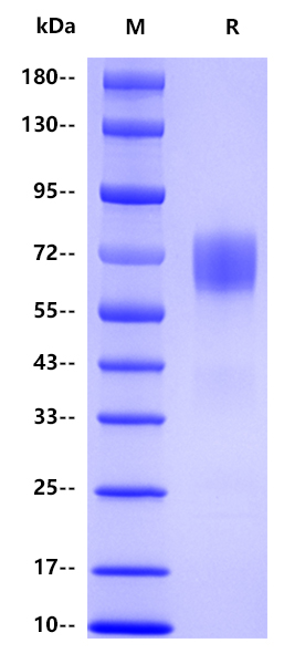Human alpha2-antiplasmin , His tag