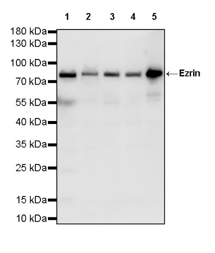 Ezrin Recombinant Rabbit mAb (S-R358)