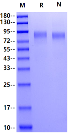 GUCY2C His Tag Protein, Mouse