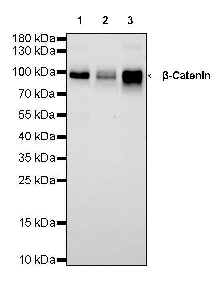 β-Catenin Recombinant Rabbit mAb (SDT-336-23)