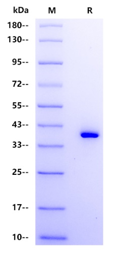 Human CCL22 Protein, hFc tag