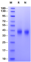 SLAMF7/CRACC/CD319 His Tag Protein, Cynomolgus