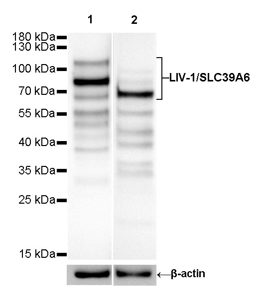 LIV-1/SLC39A6 Recombinant Rabbit mAb (SDT-206-84)