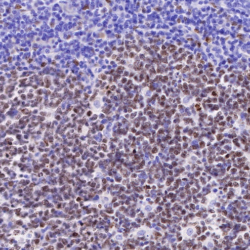 Ki67 Mouse mAb (SDT-606-33)