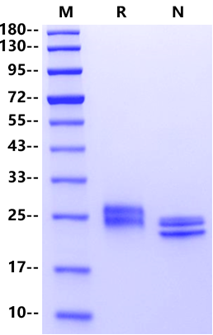 CLEC3B His Tag Protein, Human