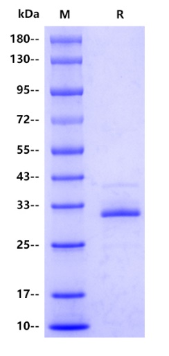 Mouse CXCL10/IP-10/CRG-2 Protein, hFc tag