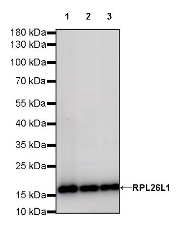 RPL26L1 Recombinant Rabbit mAb (S-R317)