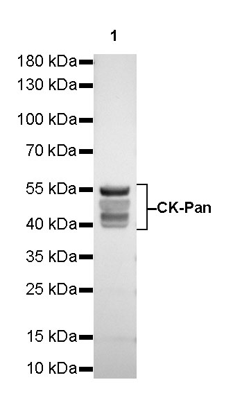 S-RMab® CK-Pan Recombinant Rabbit mAb (SDT-P001)
