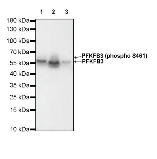 PFKFB3 Recombinant Rabbit mAb (S-653-35)