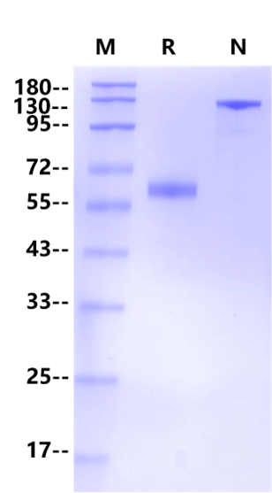 Siglec-15 Fc Chimera Protein, Human