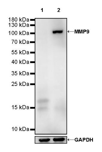 MMP9 Recombinant Rabbit mAb (SDT-368-16)
