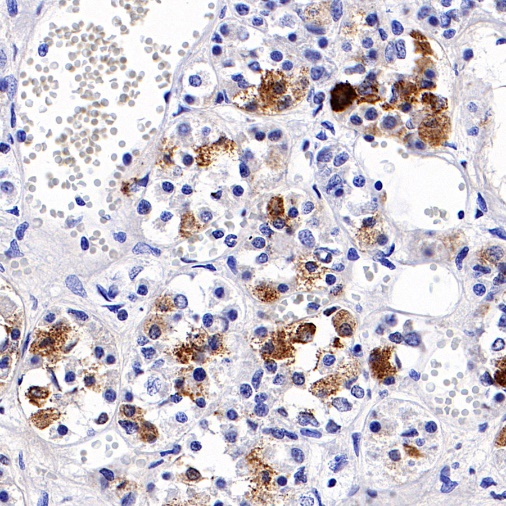 S-RMab® FSHB Recombinant Rabbit mAb (SDT-544-22)