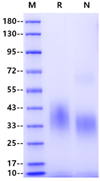 GCGR His Tag Protein, Human