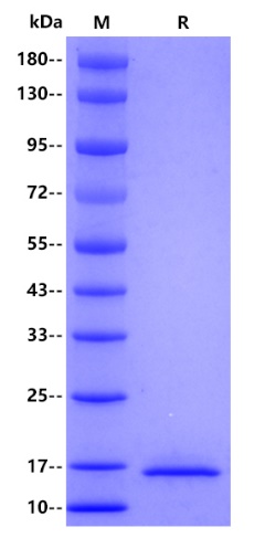 Human Cystatin C protein, His tag