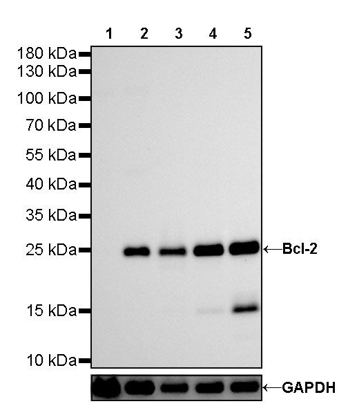 S-RMab® Bcl-2 Recombinant Rabbit mAb (SDT-R160)