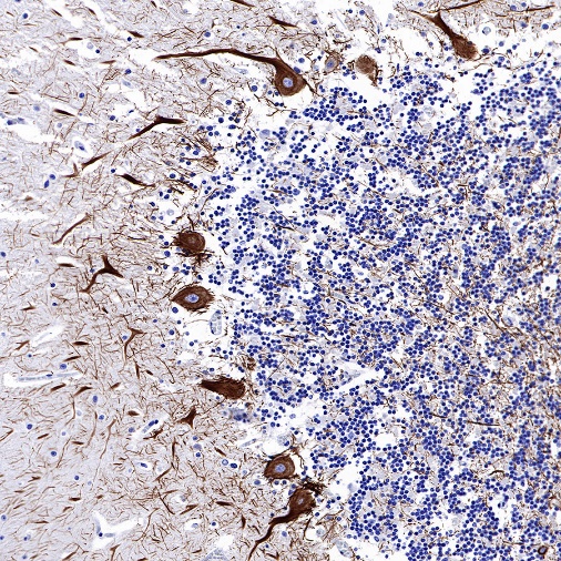 Neurofilament H Recombinant Rabbit mAb (S-532-103)