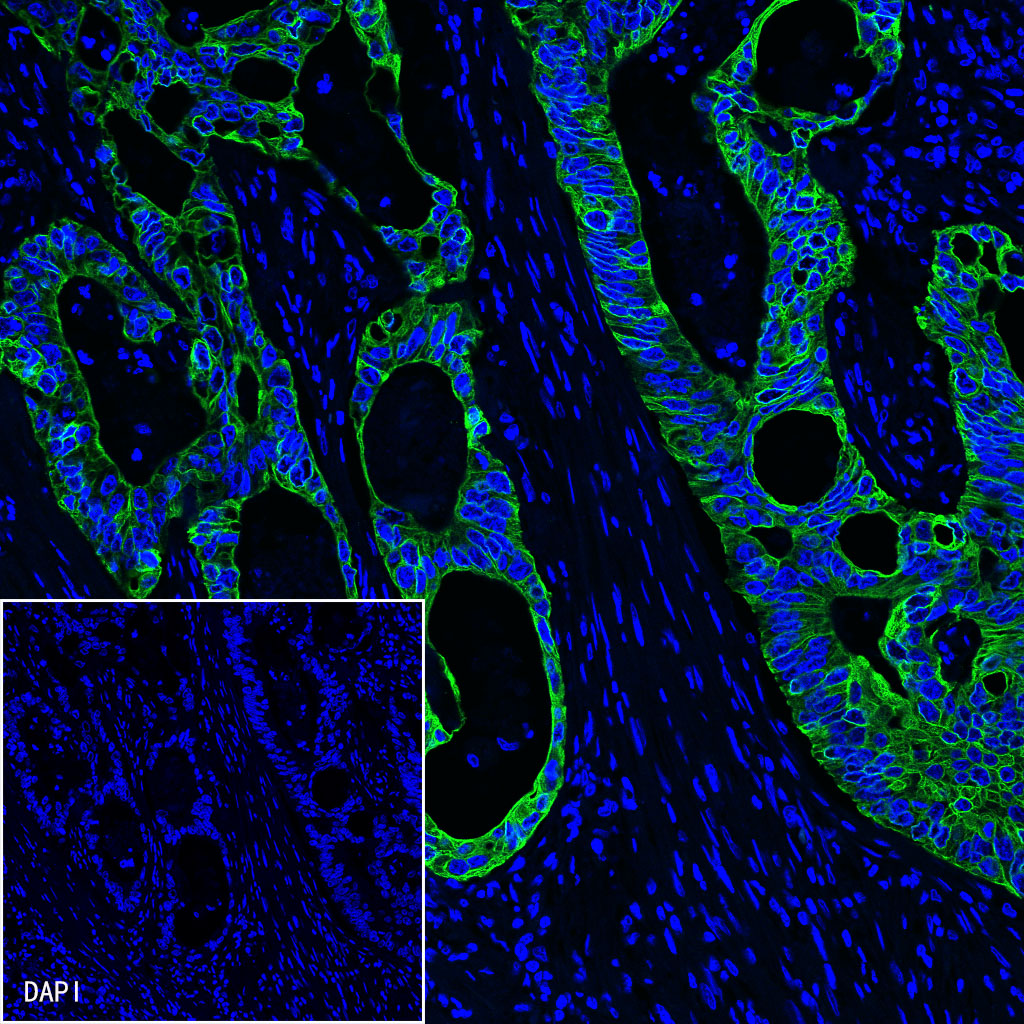 CK8/18 Recombinant Rabbit mAb (SDT-P005)