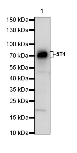 5T4 Recombinant Rabbit mAb (S-R361)