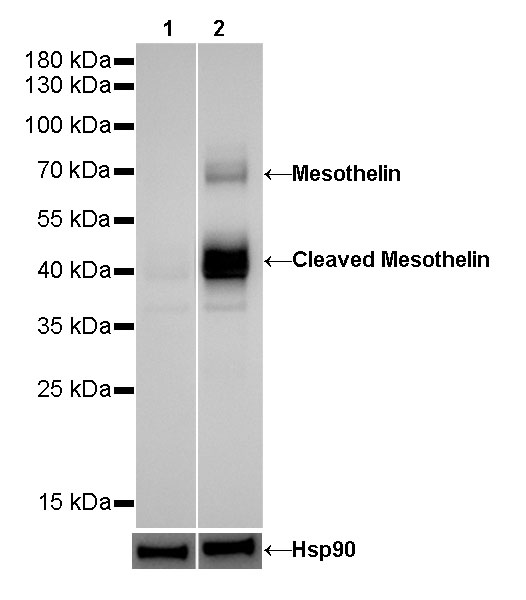 S-RMab® Mesothelin Recombinant Rabbit mAb (SDT-R070)