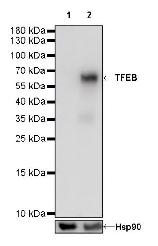 TFEB Recombinant Rabbit mAb (S-R296)