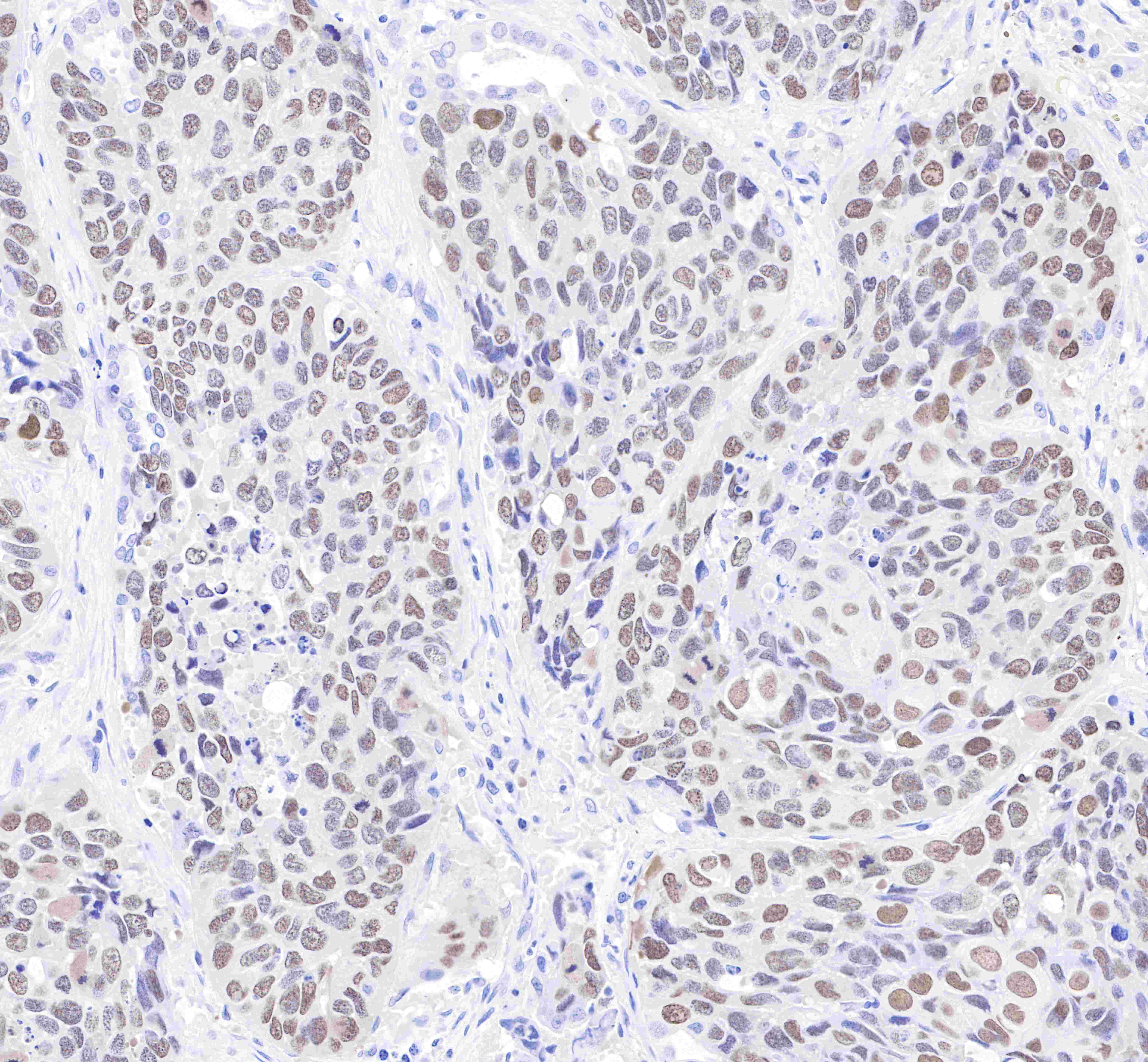 S-RMab® p63 Recombinant Rabbit mAb (SDT-054-38)
