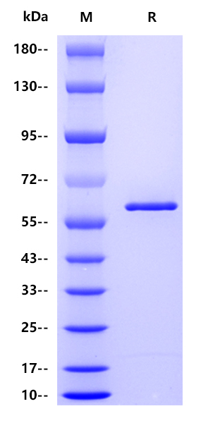 Influenza A virus NP（A/Puerto Rico/8/1934 H1N1）, His tag 