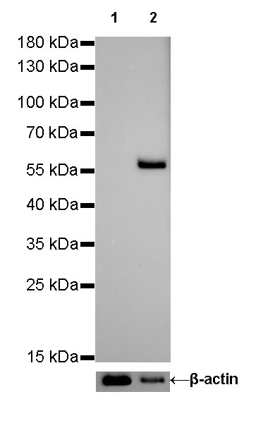S-RMab® Keratin 10 Recombinant Rabbit mAb (SDT-R067)