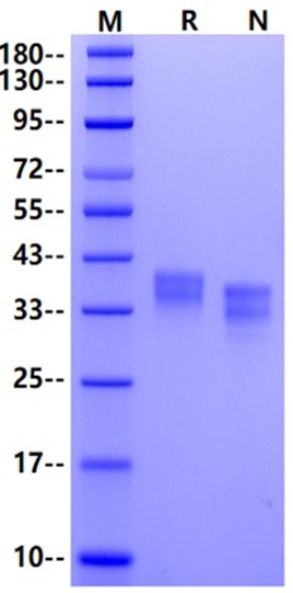 GPA33 His Tag Protein, Mouse