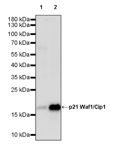 p21 Waf1/Cip1 Recombinant Rabbit mAb (SDT-1349-71)