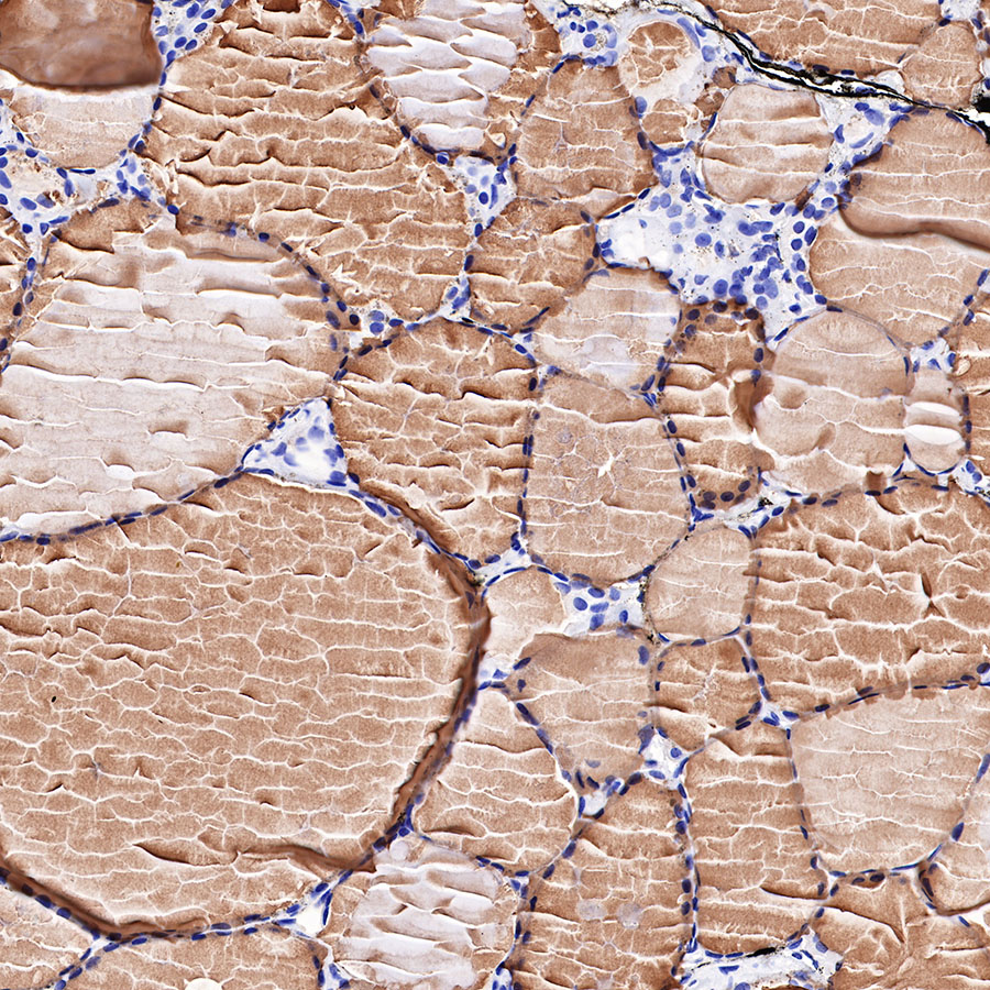 Thyroglobulin Recombinant Rabbit mAb (SDT-209-297)