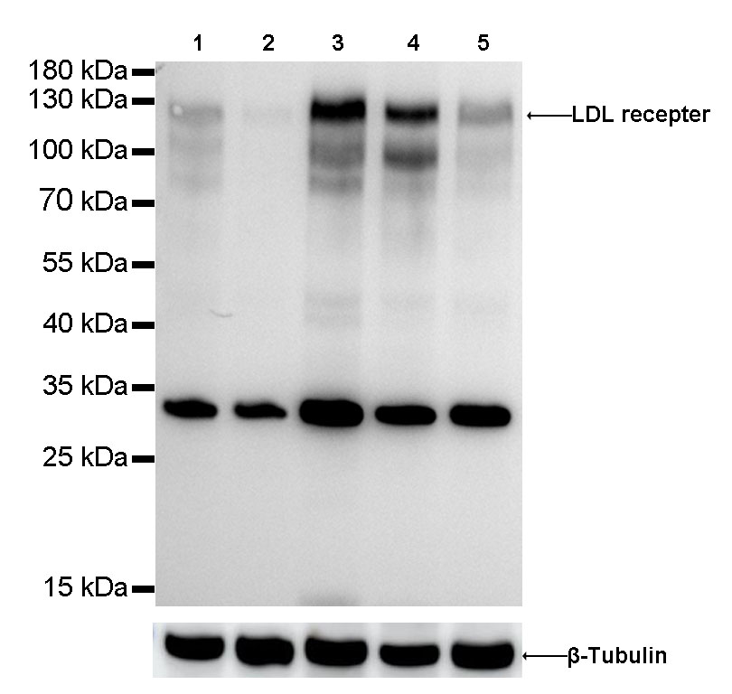 LDL receptor Recombinant Rabbit  mAb (SDT-057-57)