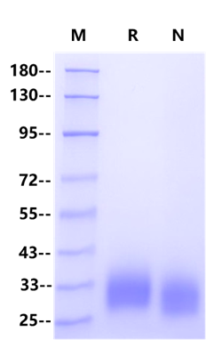GIPR His Tag Protein, Human